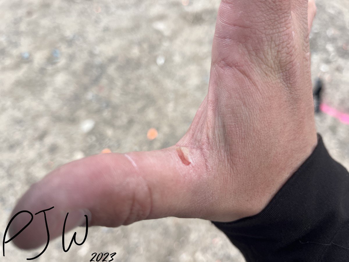 Ouchie
